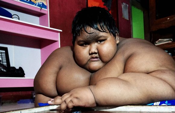 Arya Permana, así se se ve después de ser el niño mas gordo del mundo
