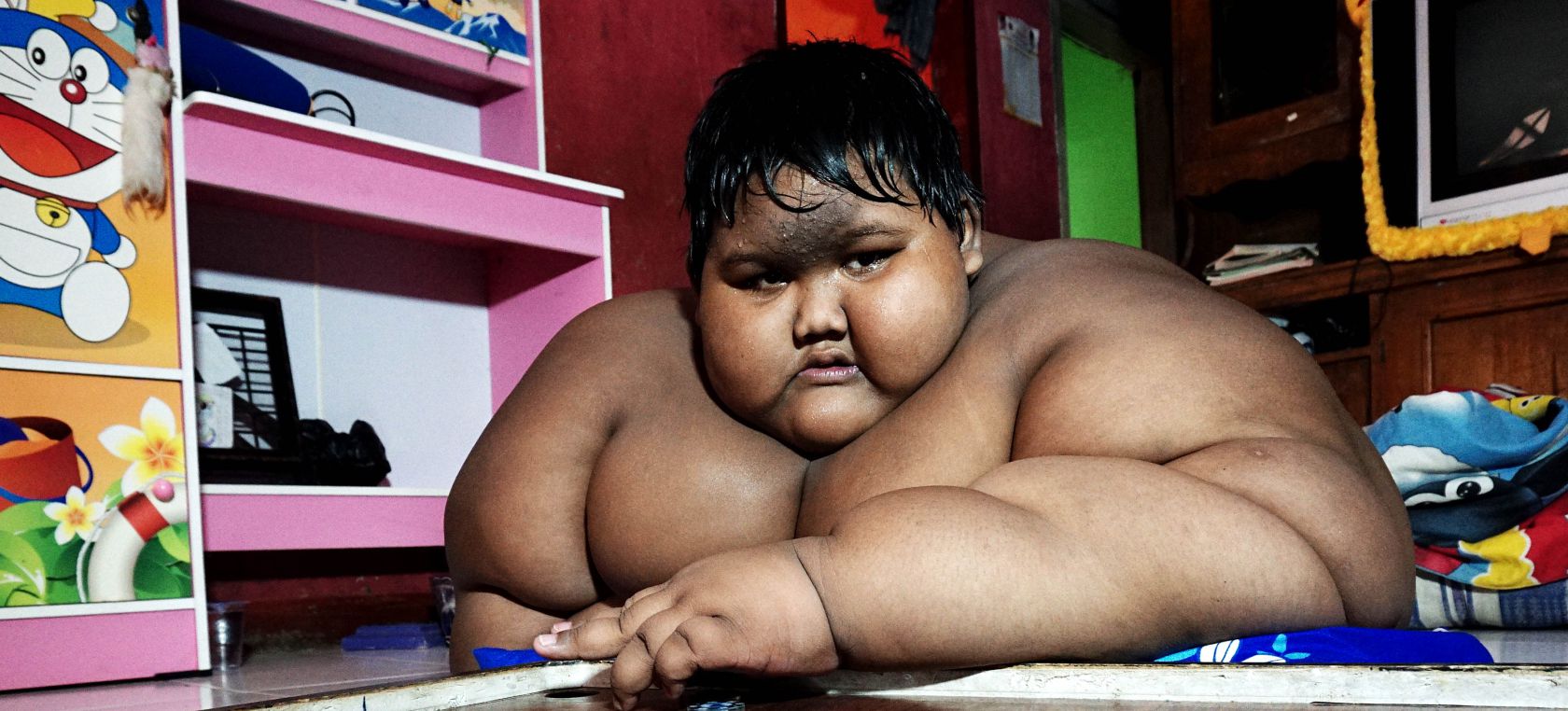 Arya Permana, así se se ve después de ser el niño mas gordo del mundo