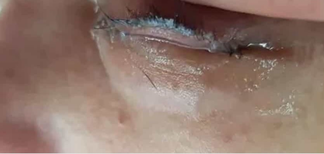 Le pegan los ojos en salón de belleza; usaron pegamento de uñas